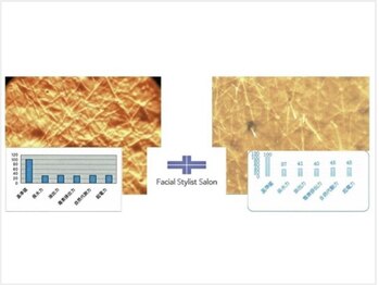 フェイシャルスタイリストサロン 四谷店/ケア例(63)