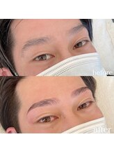 ダリ(Dali)/メンズハリウッドブロウリフト