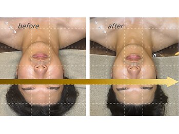 エムズプレミアム(M’s Premium)/小顔矯正_male