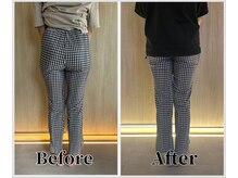 整体ラルース 中目黒(LALUZ)/30代 女性 産後骨盤矯正　変化