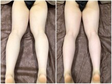 フローボディ 新山口店(flow BODY)/山口のエステはflow BODY