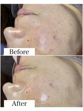 ブラックボックス(BLACK BOX)/30代女性のお客様