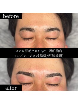 ユー 西船橋店(you)/ビフォーアフター写真