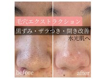 メゾン ミニョンヌ(maison mignonne)の雰囲気（技術特許！毛穴エクストラクション導入！！毛穴悩みもお任せ♪）