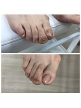 ドクターネイル爪革命 北千住店/トータルフットケア