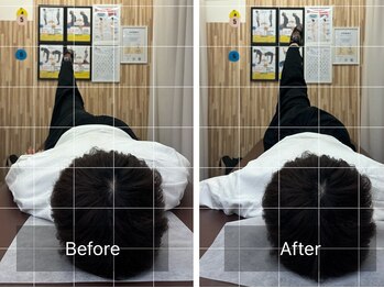 ナオル整体 札幌院(NAORU整体)/札幌円山/整体/姿勢矯正/猫背