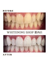 ホワイトニングショップ 葛西店/短期間で最大限に白く☆