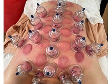 フルリール(Fleurir)/カッピングの施術写真