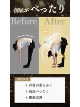 デップ 小倉店(DEP)/【小倉ピラティス】　腰痛撃退