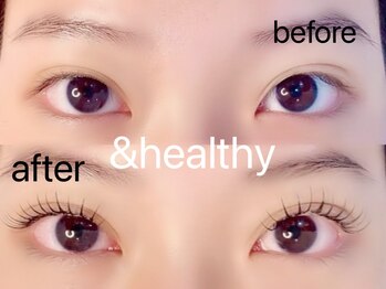 アネロ 千葉東船橋店(anello)/＆healthy120本