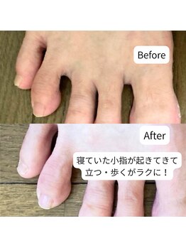 はやと整体院/50代女性(足裏の痛み)