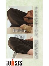 整体院オアシス イオンモール福津店(OASIS)/太もものハリ、初回での変化。