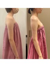 ロココ 四日市店(Rococo)/巻き肩改善