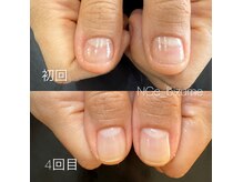 ネイル チュチュ