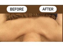 メルシー サロン(Merci Salon)/バストUPはエラスチン弾力復活♪