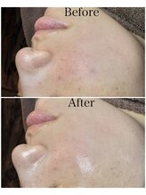 ブラックボックス(BLACK BOX)/20代女性のお客様