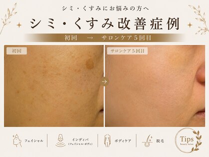 プリベンティブ ビューティー ティップス(Preventive Beauty Tips)の写真