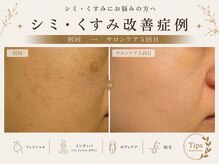 プリベンティブ ビューティー ティップス(Preventive Beauty Tips)