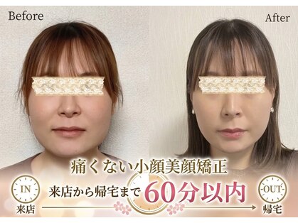 スマイルエム(SmileM)の写真