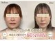 スマイルエム(SmileM)の写真