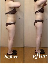 アンフィニ(infini)/短期集中8回(2.5ヶ月）