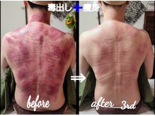 オアシス(OASIS)/ホット★カッサ