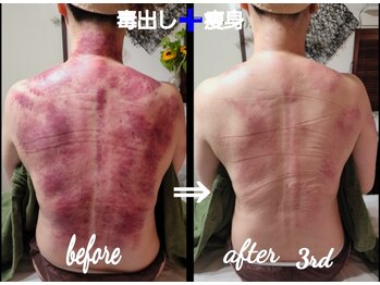 オアシス(OASIS)/ホット★カッサ