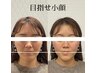 【理想の黄金比小顔】基礎骨格矯正+左右対称矯正 80分 ¥11000→¥5000