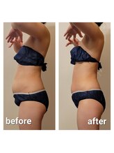 サロンドアクオン(salon de aqon)/ボディラインの変化を実感