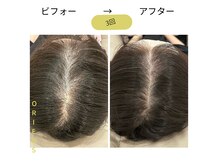 オリエンス(oriens)の雰囲気（純国産、純度100％のヒト幹細胞培養上清液トリプルショット！）