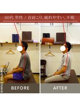 セイコツスタジオ 観音寺(SEIKOTSU STUDIO)/《首肩コリ姿勢改善》初回の変化