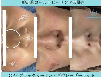 リメイククリニカルビューティー(Remake clinical beauty)/