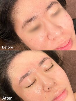 パピヨン(papillon)/ハリウッドブロウリフト【HBL】