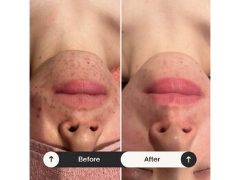 インフィニティ(INFINITY)/-CHRISTINA-コモデックス