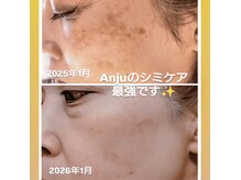 アンジュ(Anju)の雰囲気（変わる歓びをご一緒に。技術力×結果×癒しをご提供しております）