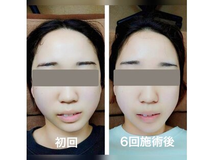 ウルオスの写真