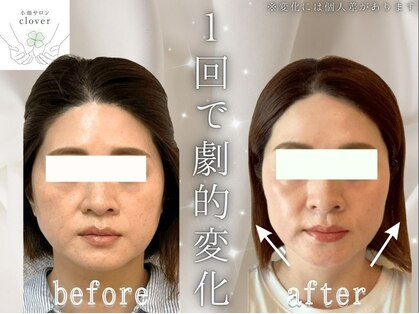 クローバー(clover)の写真