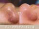 セルフィーの写真/大人女性のしつこい毛穴悩みに。完全個室の癒やし空間で受ける、熟練の毛穴洗浄＆美白パックで陶器肌へ！