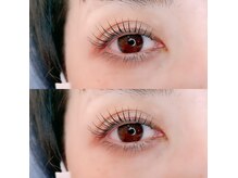 大人気のラッシュリフト、自信がつく目元に