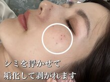 ジュパール(je pars)の雰囲気（ハーブピーリング×低周波シミケア♪）