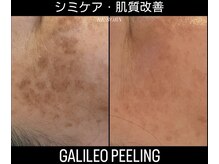 リボーン(RE:BORN)の雰囲気（シミケアは早期ケアが1番大事！シミが出る前にケアです）