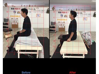 ストレチックス 近江八幡店/BeforeAfter