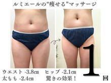 ルミエール 新宿御苑/長年の悩み解消！本気痩身技術
