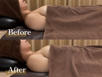 華月(KAGETSU)/美白、美容効果も抜群！