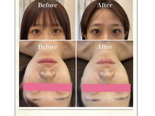 アンティアージュ 今泉店(antiage)の雰囲気（最高峰美容液と手技で脳疲労改善★リフトアップ）