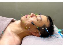 東麻布アマン(東麻布Aman)/美容鍼は男性にもオススメ