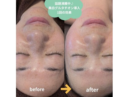 エステサロン エクラの写真