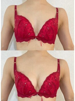 サロン ド チョコ(SALON DU CHOCO)/【バストアップ】症例