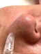 トータルサロンアイビーシー(トータルサロンIBC)の写真/【大人気】「韓国式3D毛穴洗浄」でお鼻だけでなく、全顔の毛穴の黒ずみや汚れがスッキリ！WAXオプション可