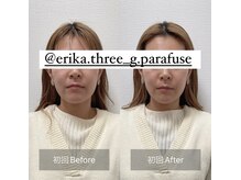 スリージー/before／after